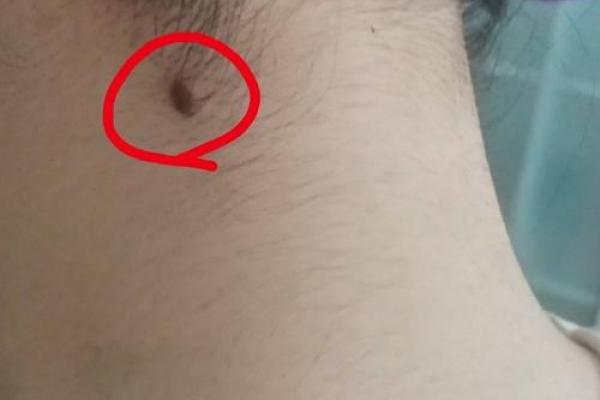 面相揭秘：男人脖子上的痣相，预示着什么？