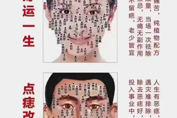 面痣风情，独特魅力一触即发