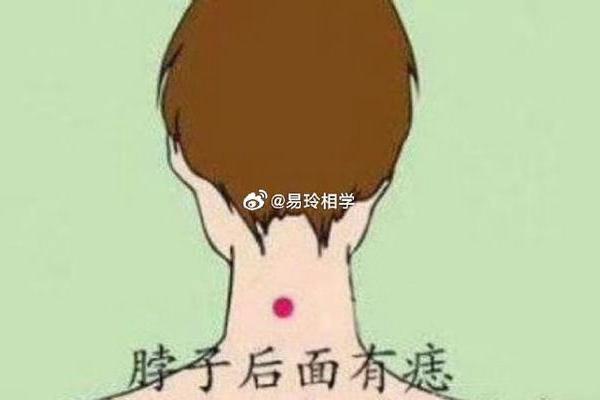 痣相消失，运势跟着走下坡？