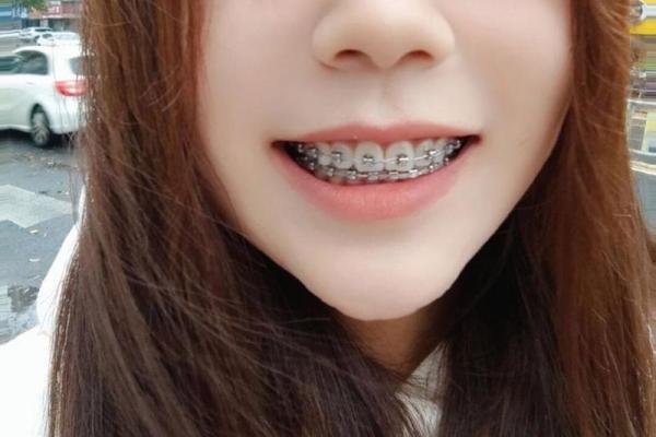 牙缝无隙显富贵