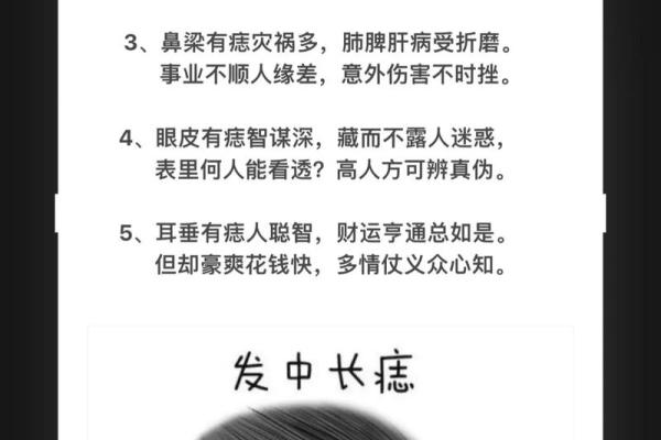 左脸痣，彰显个性风采