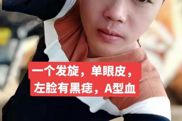 左脸痣，彰显个性风采