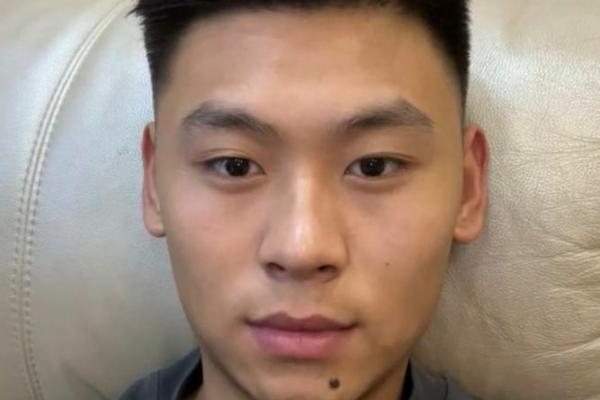下巴痣相图谱，男性运势解析宝典！