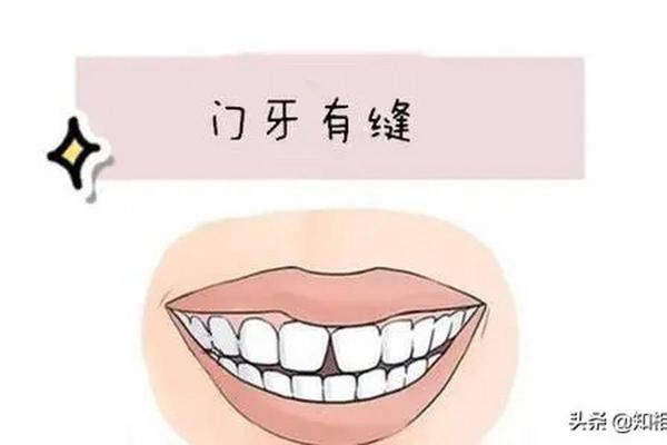 门牙吡面相：揭秘性格与命运的微妙联系
