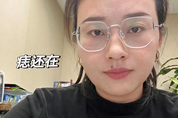 眼角一痣，风情万种