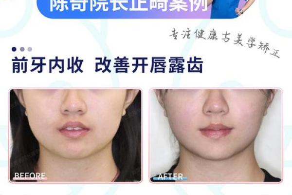 闭嘴露牙：揭秘面相中的神秘魅力