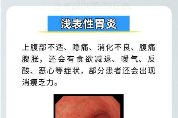 胃炎揭秘：命理角度破解胃痛之谜