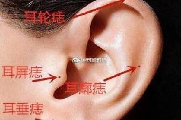 耳廓相痣图解大全，快速识别运势吉凶！