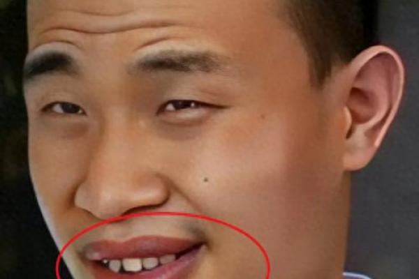 牙龈外露面相：显露命运多舛的神秘面容