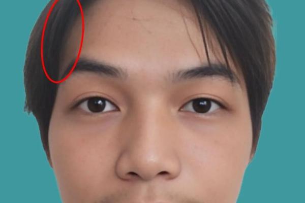 牙龈外露面相：显露命运多舛的神秘面容