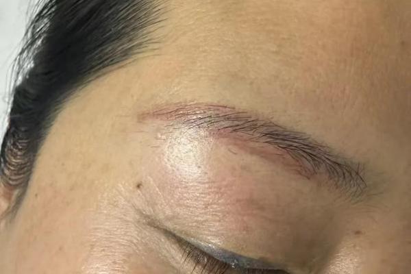 眉头一点红，运势翻倍！