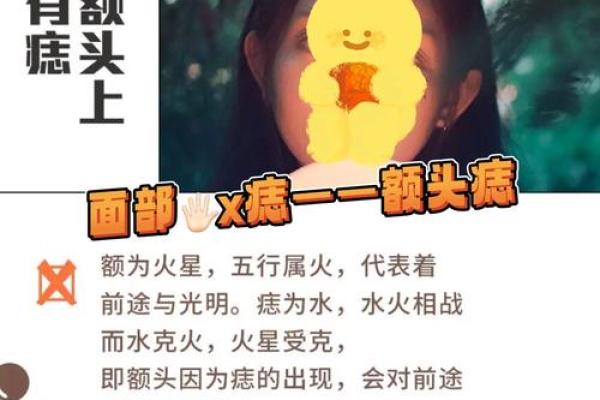 印堂痣：揭秘命运之痣的神奇力量