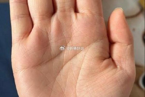 分叉之谜：手相中希望纹的分叉暗示了什么？