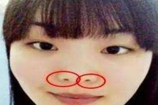 猿鼻面相解析：揭秘神秘面相背后的寓意与命运