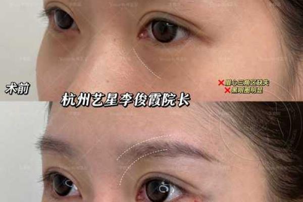 面相揭秘：眼卧蚕丝透露的运势秘密