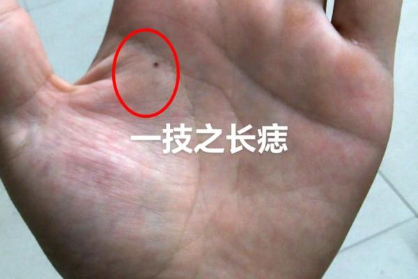 手上痣相解读：男人运势大揭秘，运势好痣相多！