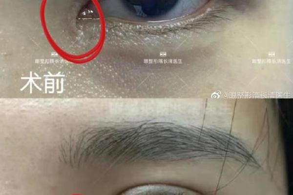面相揭秘：眼角疤痕暗藏命运密码