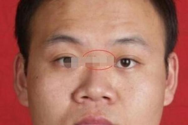 面相解码：鼻头下垂背后的命运启示