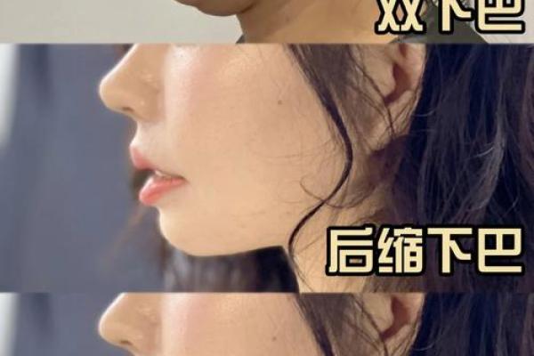 利用风水调整提升面部线条，摆脱双下巴困扰