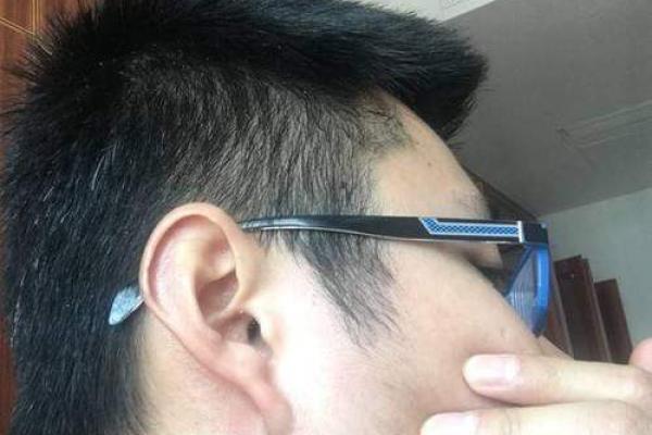 神秘痣相揭秘：长毛毛竟暗示大富大贵！