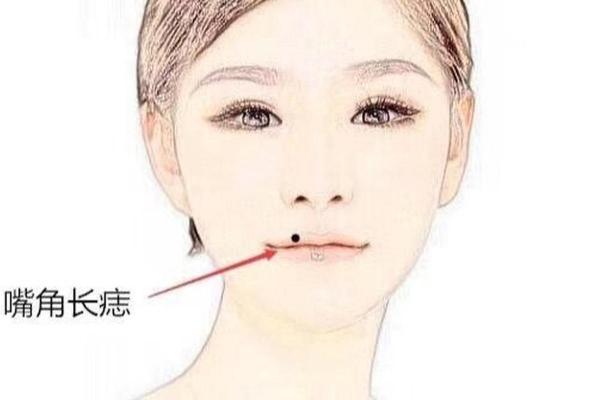 嘴唇上方痣，财运亨通的神秘标志！
