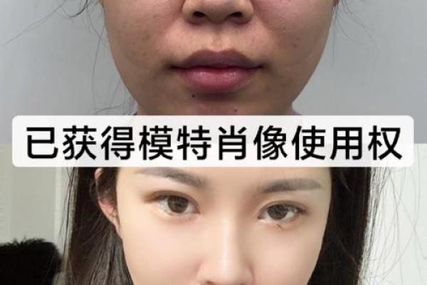 鼻子高挺面相整容，逆袭女神的秘密武器！