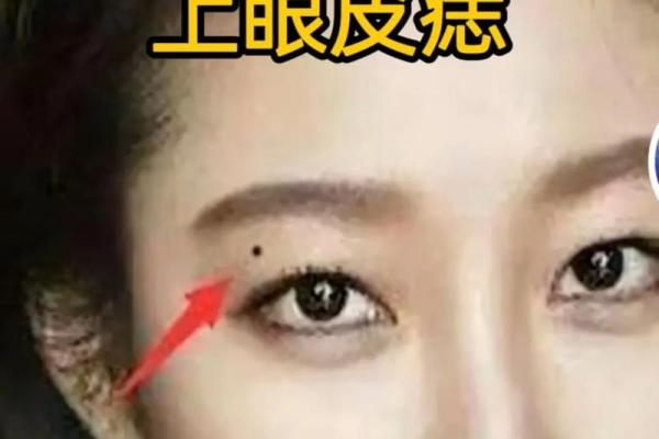 右眼皮有痣的男人，财运亨通的秘密！