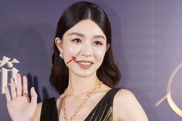 痣在法令纹旁，美丽与神秘并存