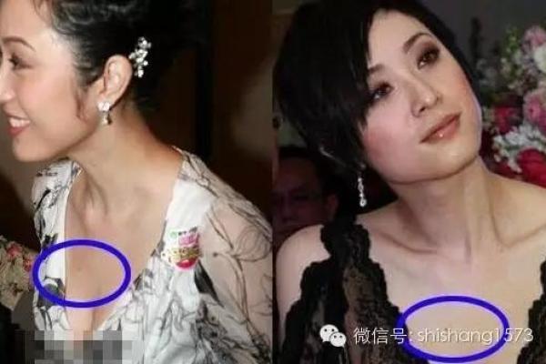 痣相中的风情万种：揭秘胸前痣的神秘力量