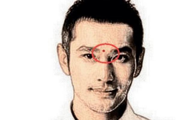 不可忽视！印堂恶痣的预示，如何化解？