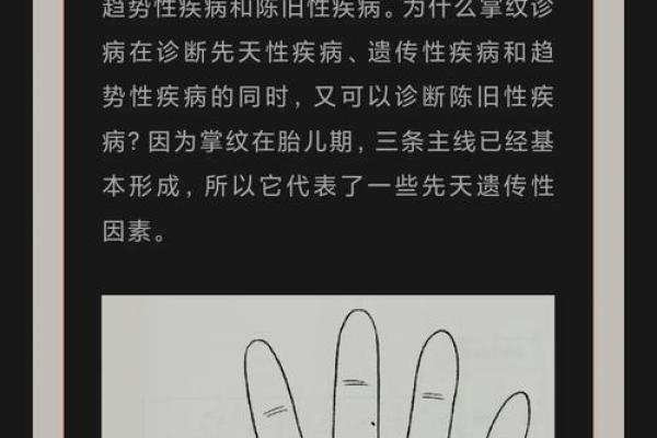神奇手相术：看掌纹识疾病，你了解多少？