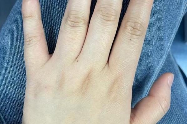 左手背有痣的女人：命运多舛还是福星高照？