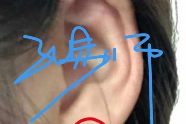 算命新潮流：耳相痣图解，一看便知命运走势！