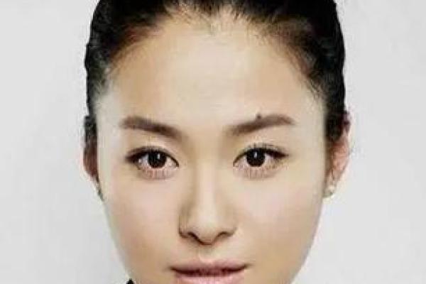 好运连连！揭秘这些痣相如何预示着美好人生