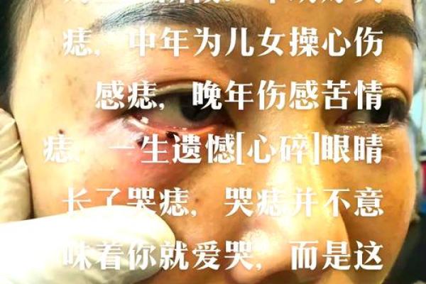 痣在何方？揭秘女性面痣相与性格命运的神秘联系