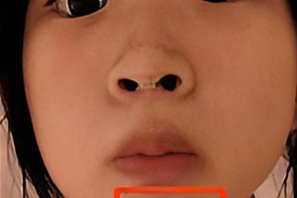 下巴半圆纹面相，财富运势双丰收的神秘面相解析！