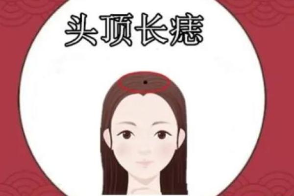 痣相宜父的秘密：揭秘那些注定好运连连的人！