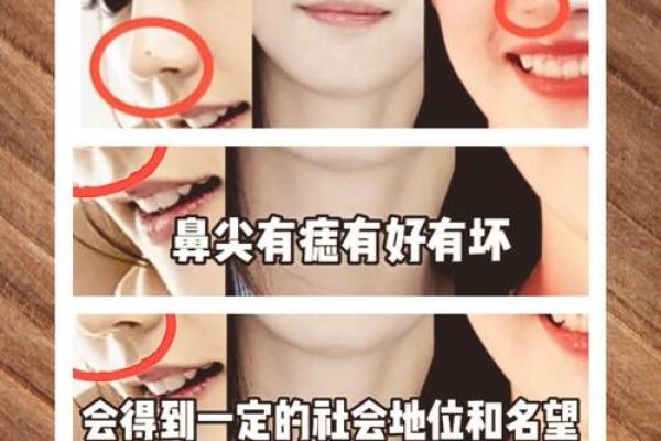 鼻痣男儿：探寻痣相背后的财运秘密