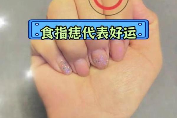 天生好命：右手痣小孩，未来不可限量！
