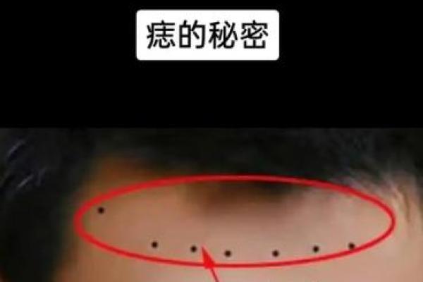 神秘痣相揭秘：桃花劫背后的惊人秘密！