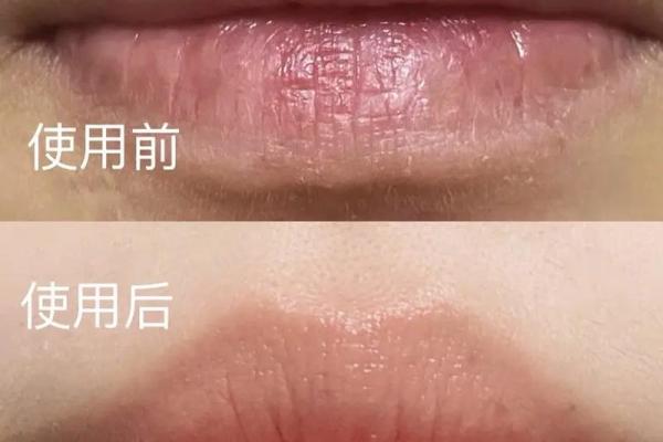 唇纹纵横显富贵