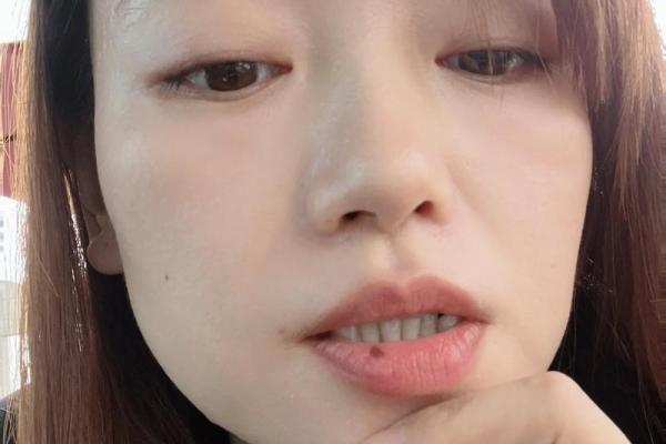 女人上唇有痣，命运如何？一探究竟！