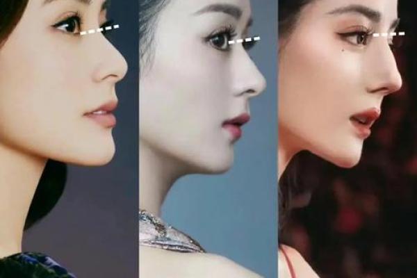 山根突起：揭秘女性面相中的高贵气质象征
