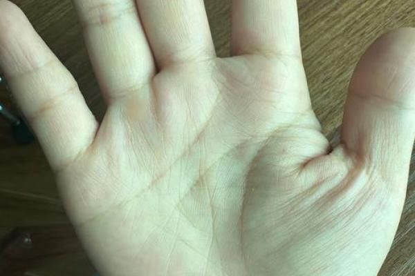 双手手相如出一辙,揭秘惊人巧合! 双手手相如出一辙,揭秘惊人巧合!