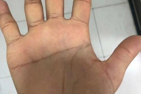 犀角头面相揭秘:洞察命运与性格的秘密 犀角头面相揭秘:洞察命运与性格的秘密