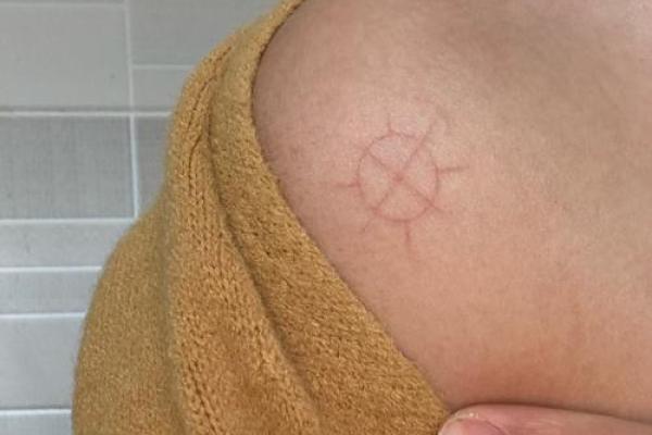 肩膀上的痣相:这些特点预示着非凡的命运! 肩膀上的痣相:这些特点预示着非凡的命运!