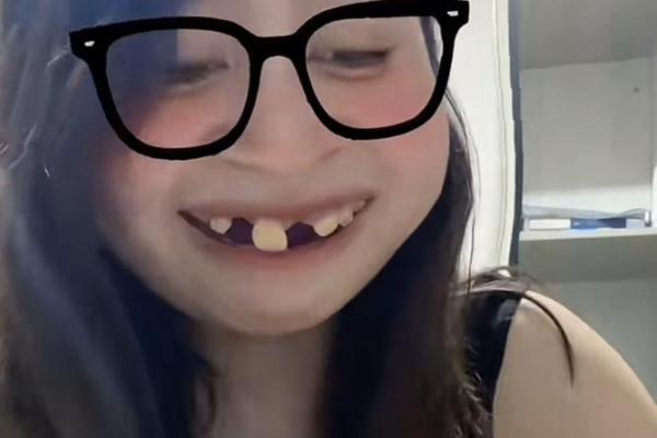 门牙掉落,笑颜依旧?揭秘颜值逆袭的秘密! 门牙掉落,笑颜依旧?揭秘颜值逆袭的秘密!